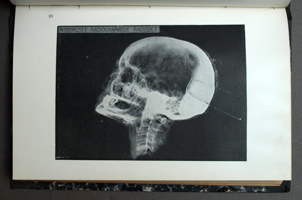 TECHNIQUE ET APPLICATIONS DES RAYONS X par G.H. Niewenglowski 1898 illustré 